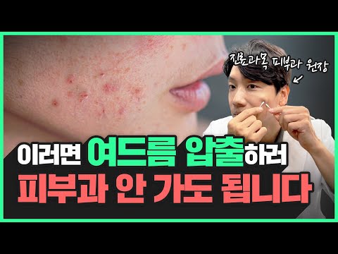 여드름 압출 꼭 해야한다? 절대로 하면 안된다? | 여드름 짜는 방법 총정리