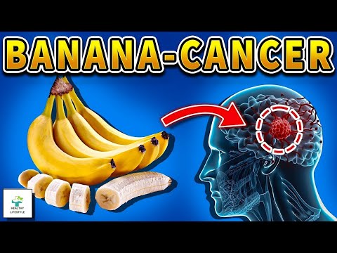 Never eat BANANAS that have "this"🍌 causing CANCER and MEMORY LOSS! 3 solution!  - Healthy lifestyle