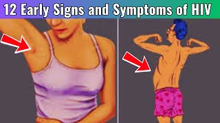 12 Warning Signs of HIV | HIV Symptoms in Men | HIV Symptoms in Women | HIV AIDS