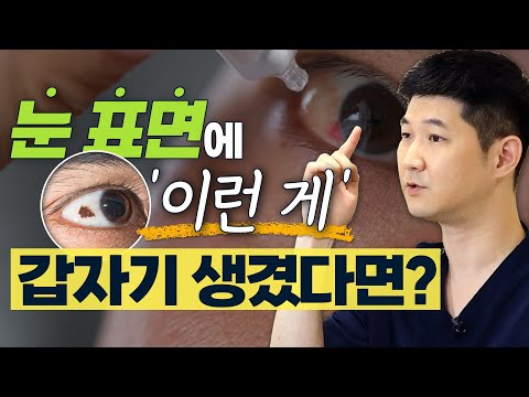 익상편? 점? 눈에 생긴 정체모를 증상, 이럴 때는 반드시 제거 수술 해야 한다? - 솔직한 안과 #14