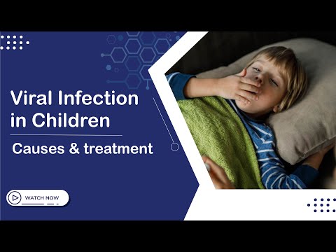 Viral Infection in Children | Causes and Treatment | Sanyra Hospital