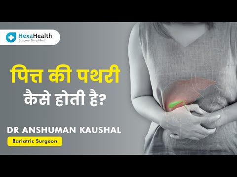 All about Gallstones & their Treatment || HexaHealth expert Dr. Anshuman Kaushal