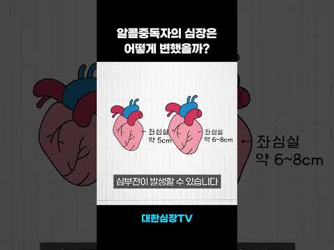 매일 술 마신 사람의 심장 모습