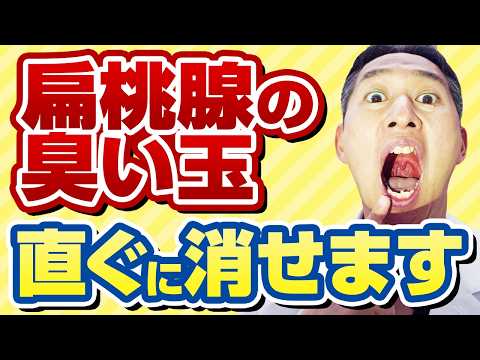 ノドの違和感や口臭の原因の臭い玉【扁桃腺の白い粒】をなくす方法