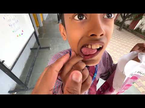 कानू का दांत टूट गया 😀 Kanu ka dant tut gaya 🧑🏼‍🦰 #vlog