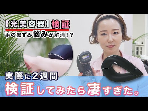 【光美容器】【肌のお悩み】必見。手の黒ずみ悩みが解消！？実際に2週間検証してみたら凄すぎた。