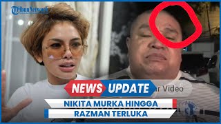 Nikita Mirzani Murka Lolly Kabur dari Rumah Aman, Razman Nasution Kena Pukul hingga Dahi Terluka