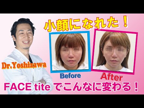 FACE tite / フェイスタイト