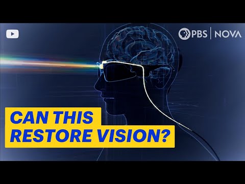 How Brain Implants Are Simulating Vision for the Blind | NOVA | PBS