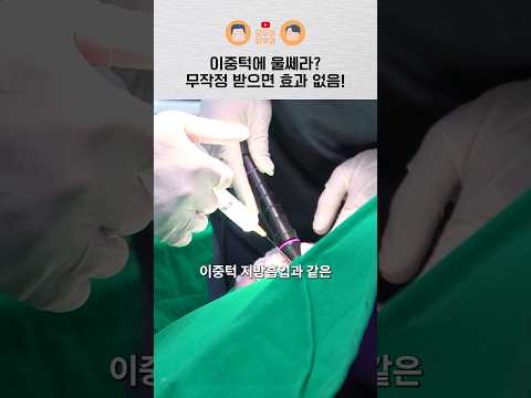 이중턱에 '울쎄라'만으로는 효과 없습니다