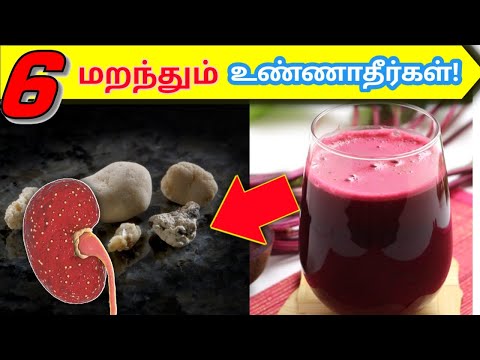 சிறுநீரக கற்களை தூண்டும் 06 உணவுகள் | 06 Bad foods for kidney stones in tamil | STAR LABORATORY