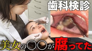 【密着】虫歯が7本も？！美女の歯科治療！