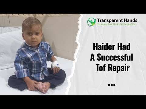 Haider Musa had a successful TOF Repair