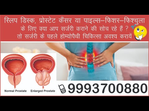 Prostate piles slip-disc pain spondylitis 50 millesimal homeopathy treatment before & After surgery