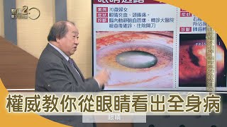 眼科權威教你　從眼睛看出全身疾病！【聚焦2.0】第381集