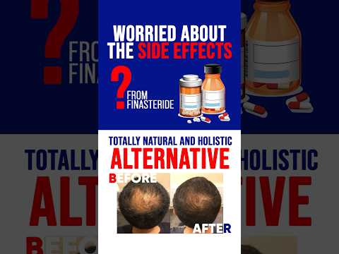 Finasteride Side Effects - Should You Worry?