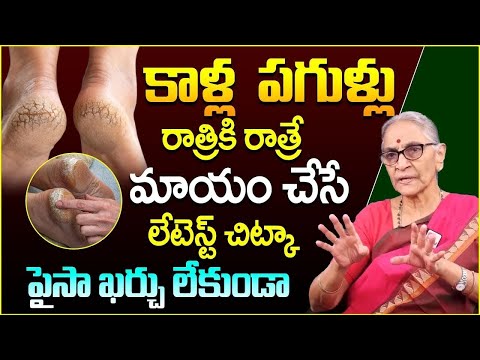 Excellent Tip For Cracked Legs | Natural Foot Cream | Cracked Heels | Anantha Lakshmi |SumanTV Prime