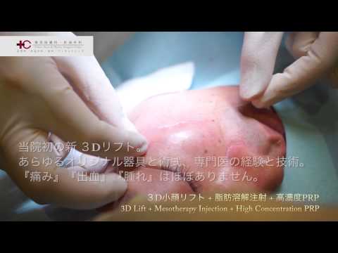 １時間で 3D小顔リフト+脂肪溶解注射+PRP（再生医療）若返り