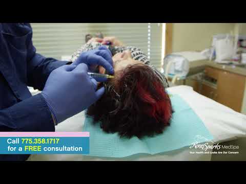 PRP (Platelet Rich Plasma) Scalp Injections for Female Hair Loss (Alopecia) - Reno Sparks MedSpa