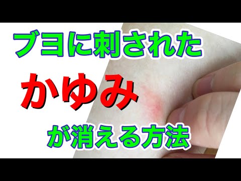 ブヨに刺された時のかゆみが劇的に治まる方法