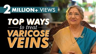 Get rid of Varicose veins | Dr. Hansaji Yogendra