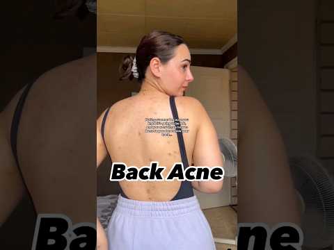 What to do for back acne? | Body Wash for Back Acne #backacne #bodywash #shorts #dadumedicalcentre