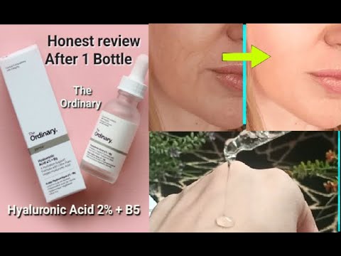 How to use HYALURONIC ACID correctly..hyaluronic acid 2% +B5 honest review