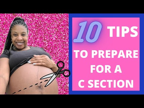 HOW TO PREPARE FOR A C SECTION | C SECTION TIPS