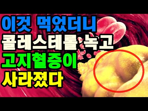 콜레스테롤 싹 긁어내어 콜레스테롤 수치 낮추는 음식 8가지. 고지혈증에 좋은 음식