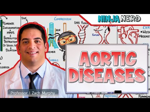 Aortic Diseases | Clinical Medicine