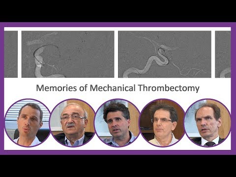 Therapies stories - Memories of Mechanical Thrombectomy