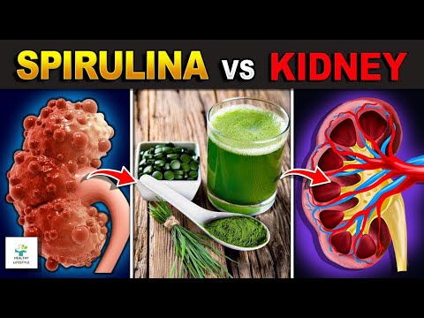 Kidney Disease (up to Stage 5) CAN Be Reversed If You Do These 6 Things | Healthy lifestyle