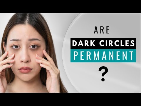 How To Get Rid of Dark Circles Permanently | 5 Home Remedies for Dark Circles under the Eyes.