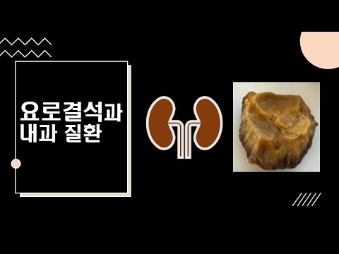 요로 결석 (2) 내과 의사가 보는 요로 결석 : 요로 결석 합병증 : 요로 결석과 만성콩팥병