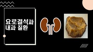 요로 결석 (2) 내과 의사가 보는 요로 결석 : 요로 결석 합병증 : 요로 결석과 만성콩팥병