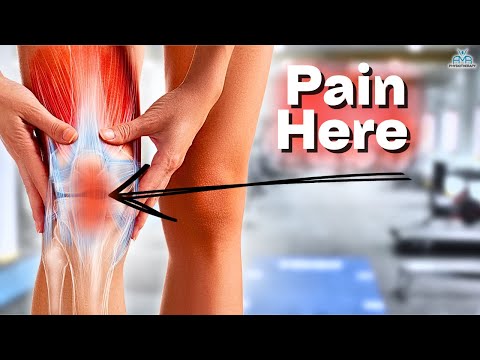 The BEST Rehab Exercises For Patella Tendinopathy!