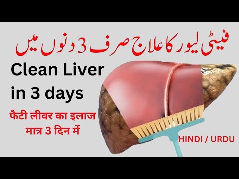 How to Clean your Fatty Liver in 3 Days #livercleanse #fattyliver #drabbasofficial #healthyliving