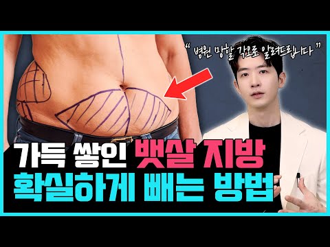 "이 방법 아니면 뱃살은 절대 안 빠집니다" 죽어도 안빠지는 뱃살 가장 빨리 빼는 법