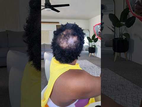 Style my NEW Big Chop with me! Natural TWA Thin Hairloss from PCOS