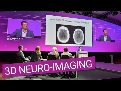 Novel advanced 3D neuro-imaging in the Angio Suite for faster treatment of ELVOs