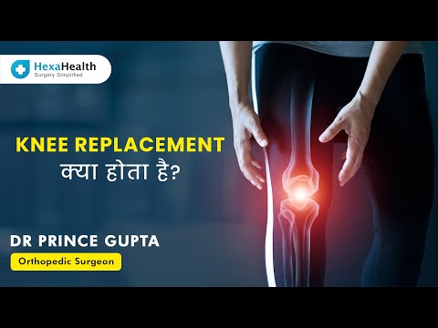 What is Total Knee Replacement Surgery? || HexaHealth expert Dr. Prince Gupta