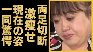 森公美子に降り掛かった悲劇の真相や現在の両足切断の姿に涙が止まらない...オペラ歌手「モリクミ」が交通事故で頭部を強打、12年間も言葉を話せず...車椅子生活を介護し続ける姿に涙が溢れる...