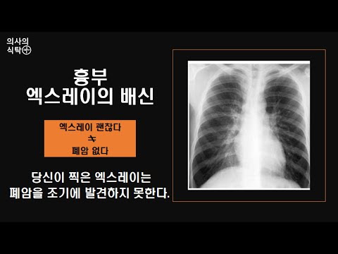 흉부 엑스레이의 배신 : 당신이 찍은 엑스레이는 폐암을 조기 진단하지 못한다.