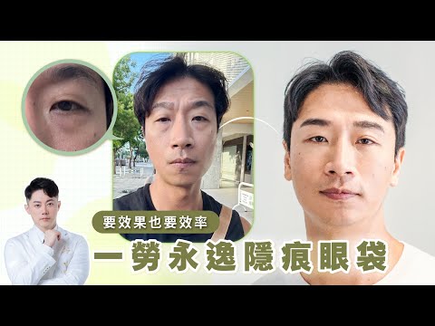 要效率也要效果！一勞永逸隱痕眼袋🌟｜台南杰美學 周杰醫師