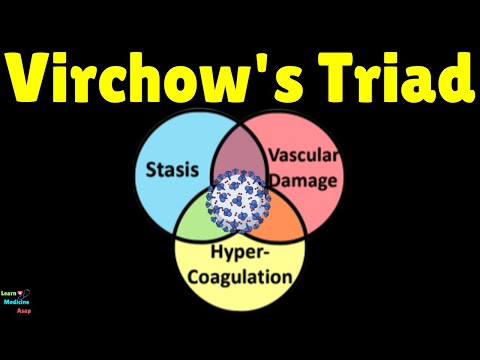 Virchow's Triad – a Risk for Thrombosis Explained | Triad of Virchow