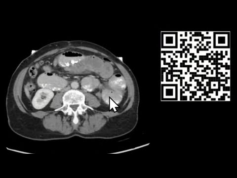 Mastering CT Abdomen and Pelvis: Emergency Course