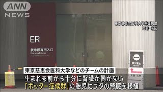 東京慈恵会医大などのチームが「ブタ腎臓移植計画」を提出　国内初の「異種移植」へ(2024年10月4日)