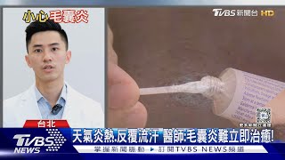 皮膚冒出「這症狀」自行處理..恐導致「蜂窩性組織炎」...醫警告:慘不忍睹!｜十點不一樣20240627 @TVBSNEWS02