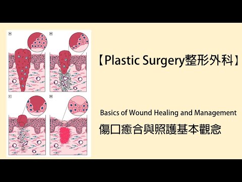 【Plastic Surgery整形外科】Basics of Wound Healing and Management傷口癒合與照護基本觀念