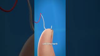 How To Remove A Fishhook 😱